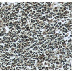 Large Multifunctional Peptidase 2 (LMP2) Antibody