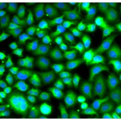 Proteasome Subunit Beta Type 8 (PSMB8) Antibody