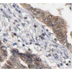 Loricrin (LOR) Antibody