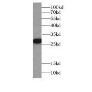 WB analysis of A431 cells using LOR antibody (1/500 dilution).