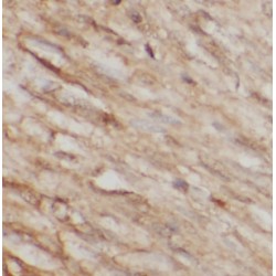 Protein-Lysine 6-Oxidase (LOX) Antibody