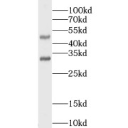 WB analysis of Jurkat cells, using LOX antibody (1/600 dilution).