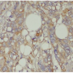 Lysophosphatidylcholine Acyltransferase 1 (LPCAT1) Antibody