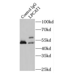 Lysophosphatidylcholine Acyltransferase 1 (LPCAT1) Antibody