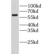 WB analysis of human lung tissue, using LPCAT1 antibody (1/4000 dilution).