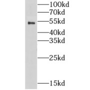 WB analysis of HeLa cells, using LPCAT2 antibody (1/500 dilution).