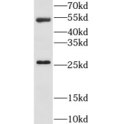 WB analysis of mouse testis tissue, using LRAT antibody (1/2000 dilution).