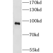 WB analysis of HeLa cells, using LRCH1 antibody (1/1000 dilution).