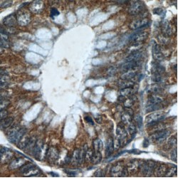 Leucine Rich Repeats And Calponin Homology Domain Containing 2 (LRCH2) Antibody