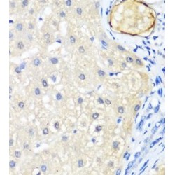 Low Density Lipoprotein Receptor Related Protein 5 (LRP5) Antibody