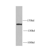 WB analysis of HeLa cells, using LRP5 antibody (1/1000 dilution).