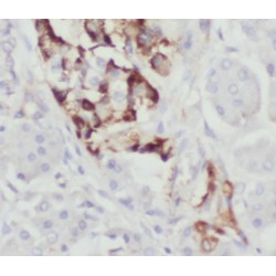 Leucine Rich Repeat Protein 1 / PPIL5 (LRR1) Antibody