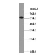 WB analysis of U-937 cells, using PPIL5 antibody (1/300 dilution).