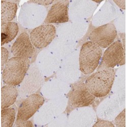 E3 Ubiquitin Protein Ligase LRSAM1 (LRSAM1) Antibody