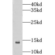 WB analysis of human spleen tissue, using LSM10 antibody (1/100 dilution).