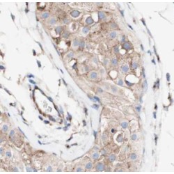 Protein LSM14 Homolog A (LSM14A) Antibody