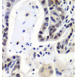 LSM2 Homolog, U6 Small Nuclear RNA And mRNA Degradation Associated (LSM2) Antibody