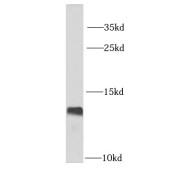 WB analysis of SW620 cells, using LSM2 antibody (1/1000 dilution).