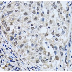 LSM4 Homolog, U6 Small Nuclear RNA And mRNA Degradation Associated (LSM4) Antibody