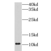 WB analysis of HeLa cells, using LSM5 antibody (1/600 dilution).