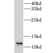 WB analysis of HeLa cells, using LSM8 antibody (1/600 dilution).