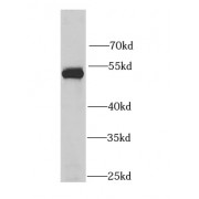 WB analysis of mouse lung tissue, using LSP1 antibody (1/1000 dilution).