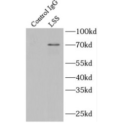 Lanosterol Synthase (LSS) Antibody