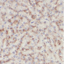 Lanosterol Synthase (LSS) Antibody