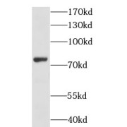 WB analysis of HeLa cells, using LSS antibody (1/500 dilution).