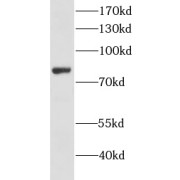 WB analysis of JurKat cells, using Lumican antibody (1/500 dilution).