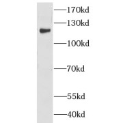 WB analysis of mouse brain tissue, using LUZP1 antibody (1/1000 dilution).