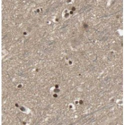 L-VOCC Antibody