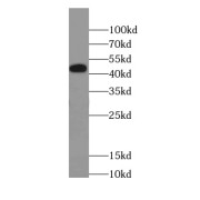 WB analysis of Transfected HEK-293 cells, using L-VOCC antibody (1/2000 dilution).