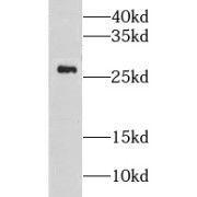 WB analysis of mouse lung tissue, using LXN antibody (1/500 dilution).