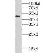 WB analysis of A431 cells, using LYAR antibody (1/500 dilution).