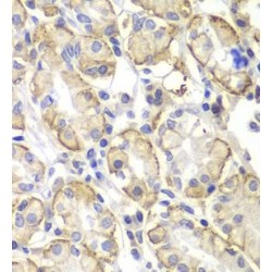 V-Yes-1 Yamaguchi Sarcoma Viral Related Oncogene Homolog (LYN) Antibody