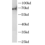 WB analysis of Jurkat cells, using LYN antibody (1/1000 dilution).