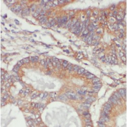 Lysophospholipase I (LYPLA1) Antibody