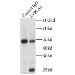 Lysophospholipase I (LYPLA1) Antibody