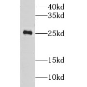 WB analysis of HeLa cells, using LYPLA1 antibody (1/500 dilution).