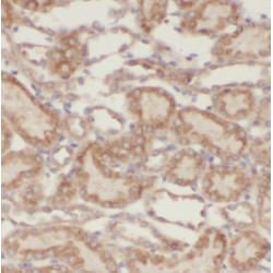 Lysophospholipase Like 1 (LYPLAL1) Antibody