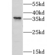 WB analysis of Neuro-2a cells, using LYSMD3 antibody (1/500 dilution).