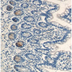 Lysozyme (LYZ) Antibody