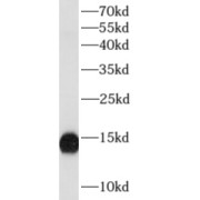 WB analysis of human spleen tissue, using LYZ antibody (1/400 dilution).