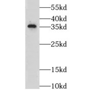 WB analysis of human testis tissue, using LZTFL1 antibody (1/500 dilution).