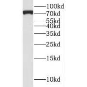 WB analysis of PC-3 cells, using LZTS2 antibody (1/300 dilution).