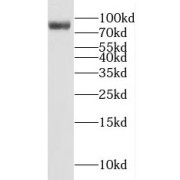 WB analysis of A431 cells, using MAD1L1 antibody (1/500 dilution).