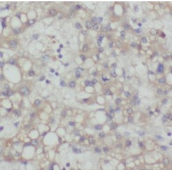 Mitotic Arrest Deficient 2 Like 1 (MAD2L1) Antibody