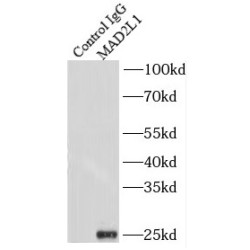 Mitotic Arrest Deficient 2 Like 1 (MAD2L1) Antibody