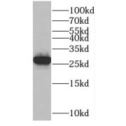 WB analysis of HEK-293 cells, using MAD2L1 antibody (1/800 dilution).